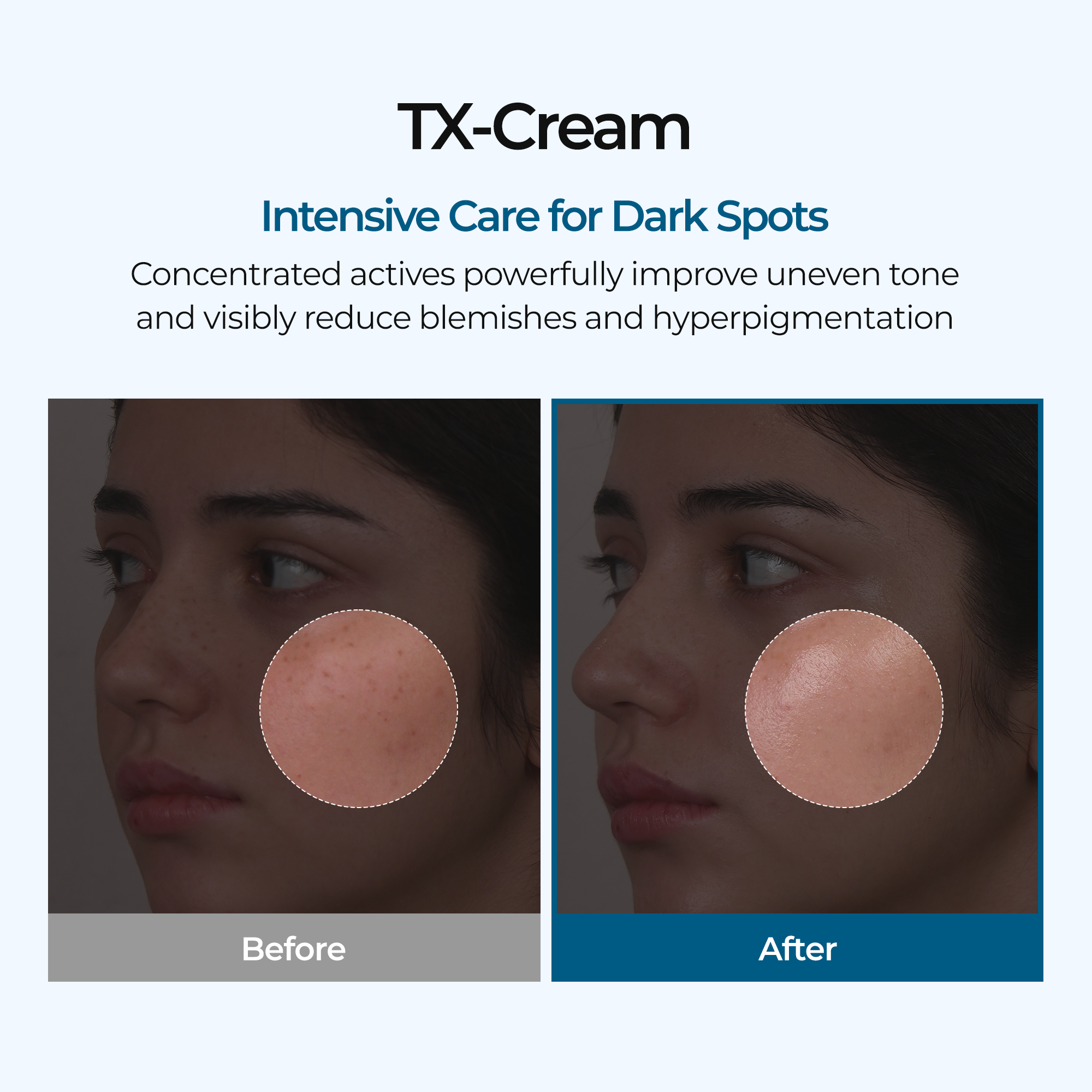 TX Cream