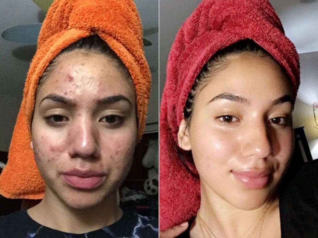 Glass Skin Essential Kit (5 pcs)